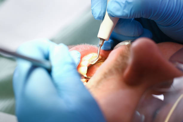 Best Dental Abscess Treatment in Smithville, TN