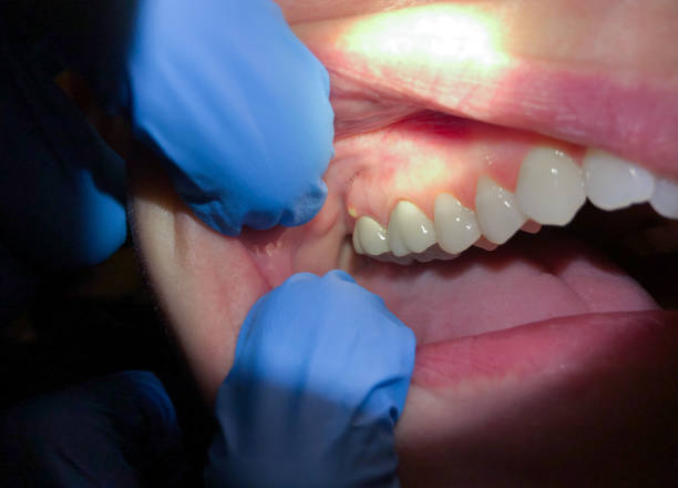 Best Emergency Care for Gum Disease in Smithville, TN